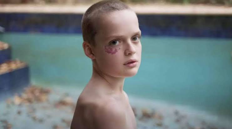 Oliver junto a la piscina en Devuélvemela